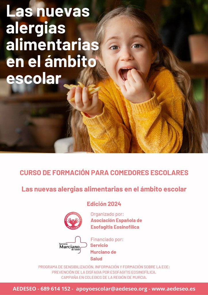 nuevas-alergias-alimentarias-en-el-colegio-curso-diloa